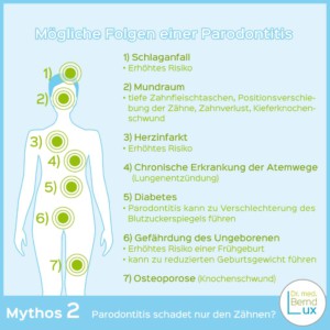 Titelbild Mythos 2 der Zahngesundheit - Zahnarzt Zerbst - Dr. med. Bernd Lux