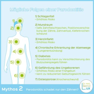 Titelbild Mythos 2 der Zahngesundheit - Zahnarzt Zerbst - Dr. med. Bernd Lux